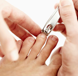 How to Prevent and Treat Ingrown Toenails
