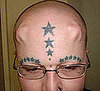 Extreme Body Modifier Has Implants in His Head