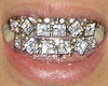 Gallery of Grillz