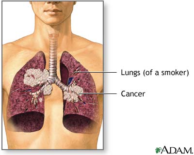 Your Children Breathe Secondhand Smoke Your Children Breathe Secondhand Smoke