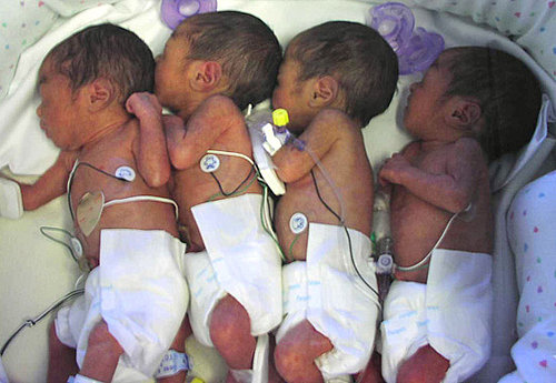 Nigerian Woman Give Birth to Quadruplets