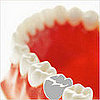 Pregnancy Mercury Fillings