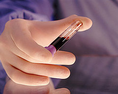 Would You Bank Your Newborn's Cord Blood? Would You Bank Your Newborn's Cord Blood?