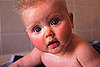 Do You Know Your Baby Skin Conditions?