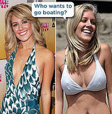 Do you think Heidi looked better before or after surgery?