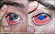 The first eye tattoo!