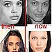 angelina jolie plastic surgeons 