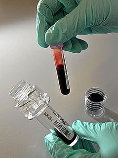 Why the Sight of Blood Makes You Feel Faint