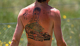 When Was the Last Time You Were Badly Sunburned?