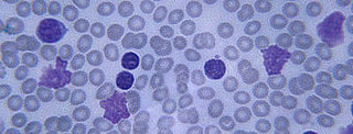 Cancer News: The Good, the Bad, and Early Detection