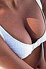 Breast Implant Alternative: Stem Cell Breast Enlargement