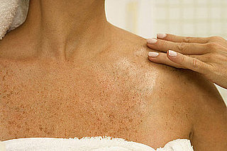 What Can You Do About Uneven Pigmentation? 