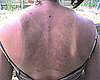 25 Reasons to Not Skip the SPF