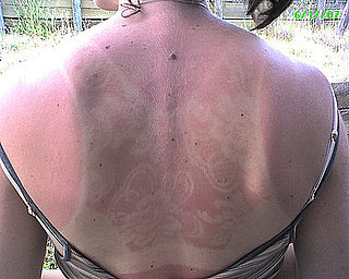 25 Reasons to Not Skip the SPF