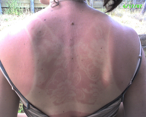 25 Reasons to Not Skip the SPF