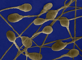 Alcohol's Effect on Sperm