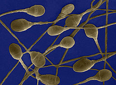 Alcohol's Effect on Sperm