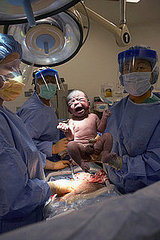 Reasons Why Women Prefer C-Sections