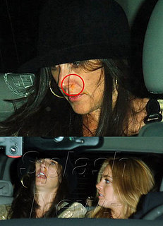 What's Up Demi's Nose?