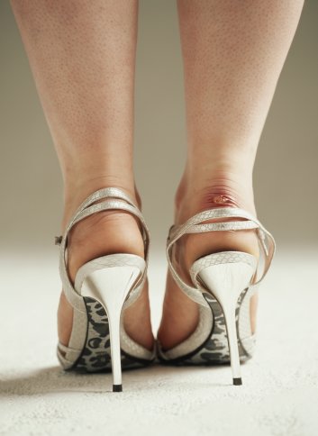 Style for Style: Blister Prevention! 