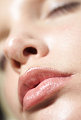 Can You Get Lip Cancer From the Sun?