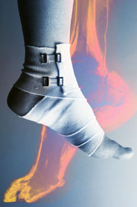 How to Avoid Sports Injuries