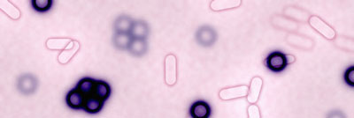 Fittingly Mad: Super Bugs Are Super Scary