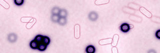 Fittingly Mad: Super Bugs Are Super Scary