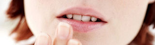 Canker Sores Are No Crack up