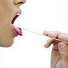 Symptoms of Strep Throat 