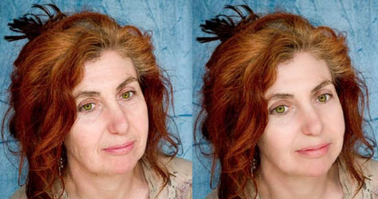 face4 face4