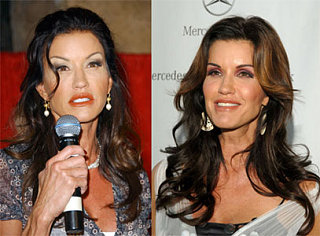 When Do You Think Janice Looked Better?