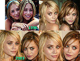 Marky Kate & Ashley Nose Job