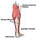 fatsoleus