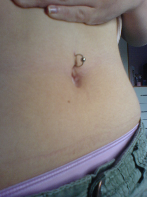 Belly Button Blunder