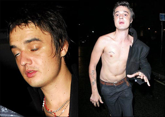 Pete Doherty Needs More Rehab