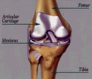 The Skinny On: Cartilage