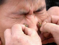Bee Sting Treatment?  Too Painful To Imagine