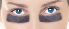 What's the Deal With: Dark Circles Under My Eyes