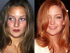 Kate hudson.. not such a natural beauty...